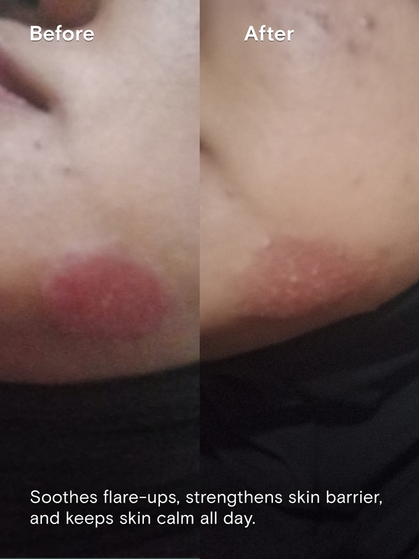 Intensive Barrier Moisturizer Cream