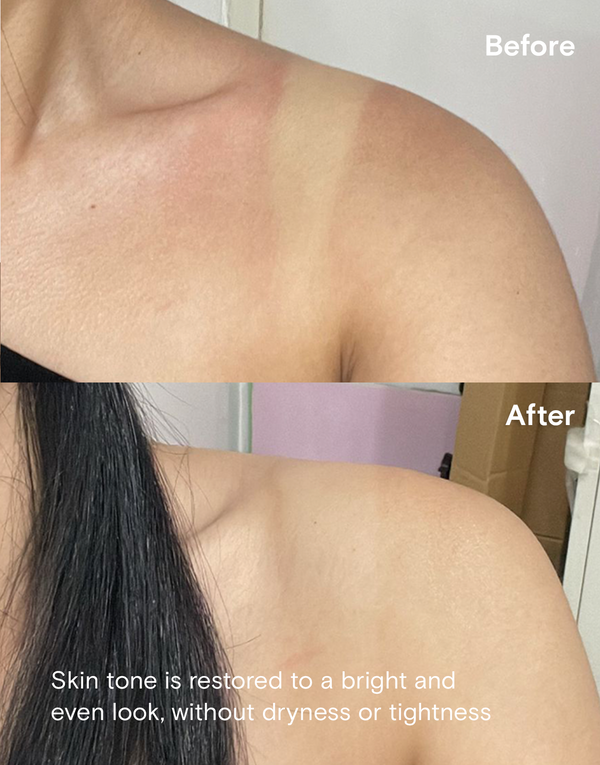 Pure Kojic Soap