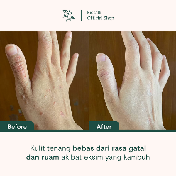 Biotalk Bundle Honey Calendula Body Wash + Refill Pack | No SLS/SLES | Sabun Mandi Cair Natural | Melembabkan dan Menenangkan Kulit Eksim Psoriasis Sensitif Alergi Kering