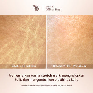 [BUY 1 GET 1] Biotalk Stretch Mark Oil + Coffee Scrub Soap 30GR