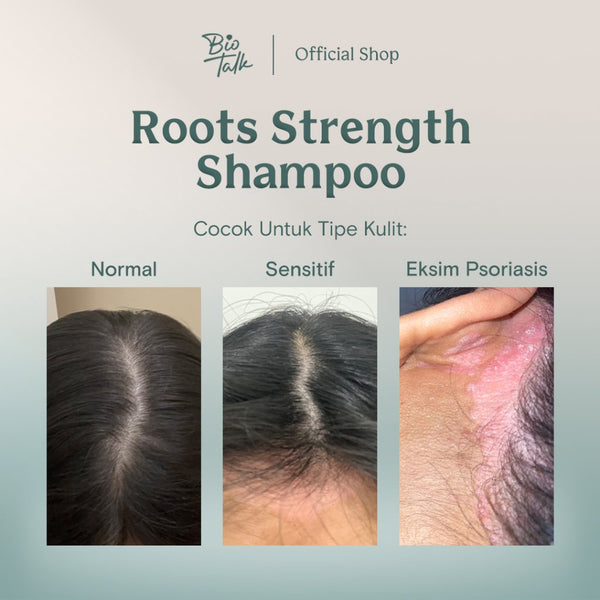 [NEW LAUNCH] Biotalk Roots Strength Shampoo I 250ml I Non SLS/SLES I Natural I Perawatan Rambut Rontok Karena Catokan Styling Hairdryer Kering Rontok Karena Pewarnaan Rambut