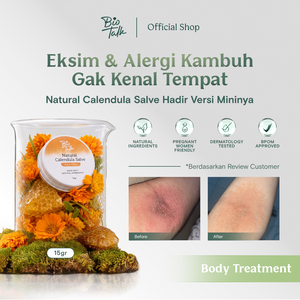 [NEW LAUNCH] Biotalk Natural Calendula Salve Mini I 15gr I No Steroid I Meredakan Kulit Eksim Psoriasis Sensitif Gatal-Gatal I Membantu Meredakan Alergi Kulit Gatal