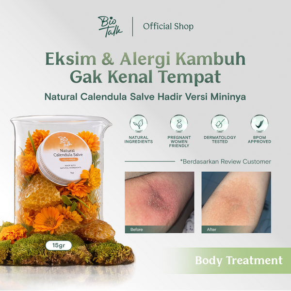 [NEW LAUNCH] Biotalk Natural Calendula Salve Mini I 15gr I No Steroid I Meredakan Kulit Eksim Psoriasis Sensitif Gatal-Gatal I Membantu Meredakan Alergi Kulit Gatal