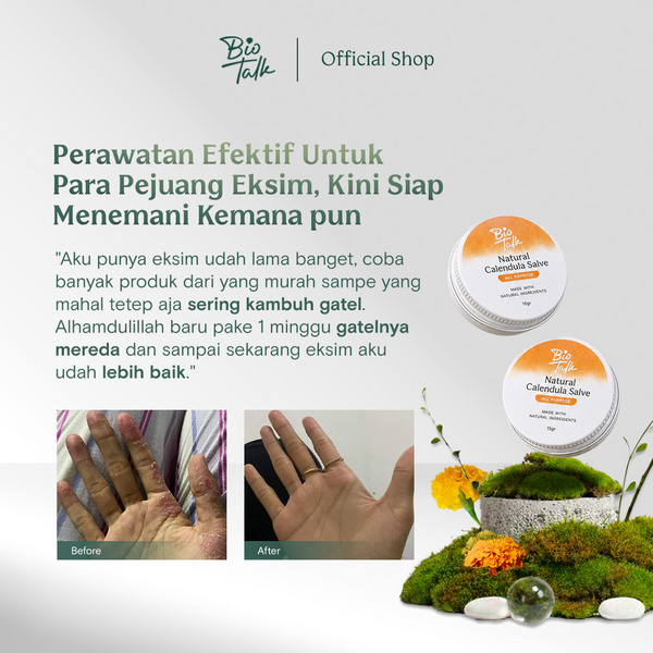 [NEW LAUNCH] Biotalk Natural Calendula Salve Mini I 15gr I No Steroid I Meredakan Kulit Eksim Psoriasis Sensitif Gatal-Gatal I Membantu Meredakan Alergi Kulit Gatal